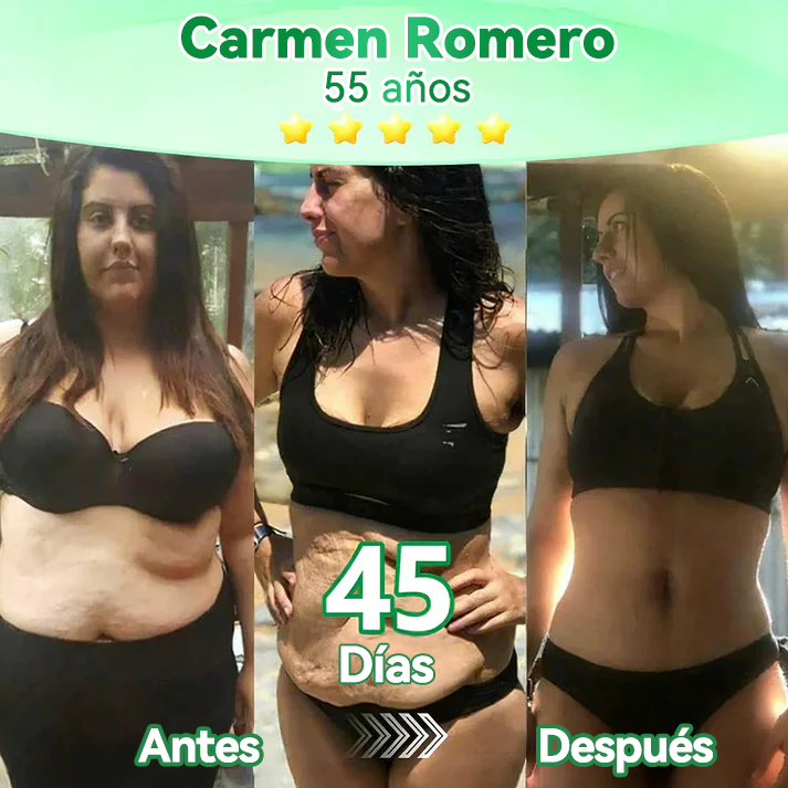 𝑻𝒊𝒆𝒏𝒅𝒂 𝑶𝒇𝒊𝒄𝒊𝒂𝒍 |🍓🍓𝐹𝑙𝑜𝑟𝑖𝑠𝑚𝑎® 10 𝑬𝑵 1 𝑴𝒐𝒓𝒊𝒏𝒈𝒂 𝒀 𝑩𝒆𝒓𝒃𝒆𝒓𝒊𝒏𝒂 𝑷𝒂𝒓𝒄𝒉𝒆 𝑨𝒗𝒂𝒏𝒛𝒂𝒅𝒐 𝑫𝒆 𝑴𝒊𝒄𝒓𝒐𝒏𝒆𝒆𝒅𝒍𝒆𝒔 𝑵𝒂𝒏𝒐 (𝑼𝒏𝒂 𝒗𝒆𝒛 𝒂𝒍 𝒅í𝒂, 𝒄𝒂𝒎𝒃𝒊𝒐𝒔 𝒗𝒊𝒔𝒊𝒃𝒍𝒆𝒔 𝒆𝒏 7 𝒅í𝒂𝒔) ✅ 𝑶𝒃𝒆𝒔𝒊𝒅𝒂𝒅, 𝑫𝒊𝒂𝒃𝒆𝒕𝒆𝒔, 𝑨𝒑𝒏𝒆𝒂 𝒅𝒆𝒍 𝑺𝒖𝒆ñ𝒐 𝒚 𝑷𝒓𝒐𝒃𝒍𝒆𝒎𝒂𝒔 𝑨𝒓𝒕𝒊𝒄𝒖𝒍𝒂𝒓𝒆𝒔